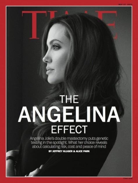 ORA ANCHE GLI UOMINI COPIANO ANGELINA JOLIE ! I CHIRURGHI ASPORTANO LE GHIANDOLE PROSTATICHE DEGLI UOMINI PORTARTORI DEL GENE BRCA