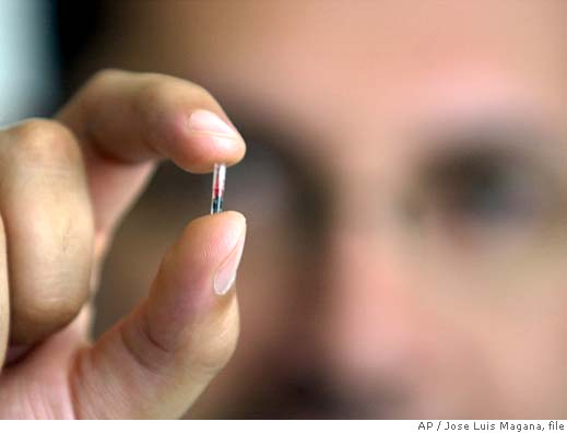 OPERAZIONI CONTI CORRENTI: A QUANDO IL CHIP SOTTOPELLE ?