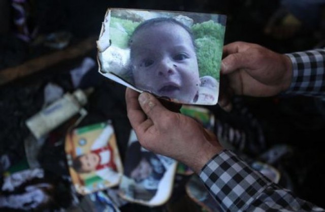 UN INFANTE PALESTINESE BRUCIATO? BE’, E ALLORA?