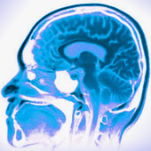 MORTE CEREBRALE, MOSTRUOSITA' INVENTATA DALLA SCIENZA