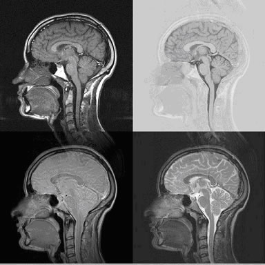 TECNOLOGIE INTRUSIVE DI SORVEGLIANZA CHE LEGGONO IL CERVELLO PENETRANDO LA MENTE