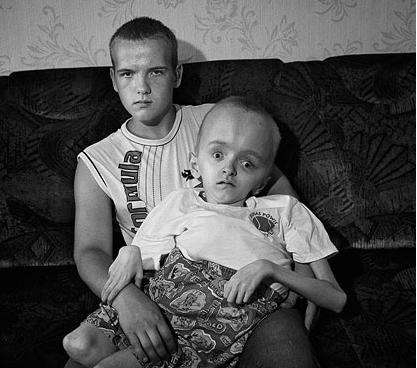 IN DIRETTA DA CHERNOBYL