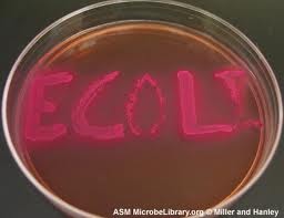 ESCHERICHIA COLI + GERMANIA + ARMA BIOLOGICA