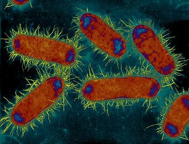 E. COLI G.M., I SIGNIFICATI DI UN ATTO DI BIOTERRORISMO OCCULTATO DAL DARWINISMO
