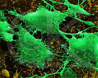 IL CANCRO, ANCORA UN MISTERO PER LA SCIENZA MEDICA