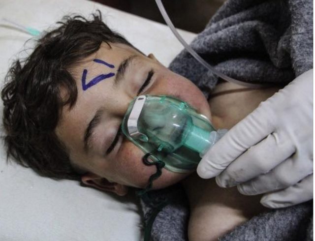 Ordered Censored by Trump ! Secondo le Associazioni Mediche Svedesi i Caschi Bianchi hanno ammazzato i bambini per girare il falso video sull' Attacco con i Gas
