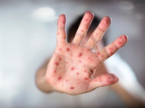 Fanta-Epidemia e veri sciacalli