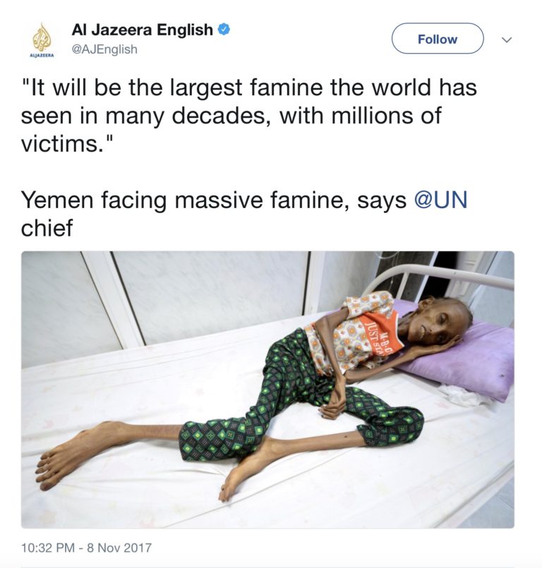 I milioni di Facce della Fame in Yemen per il Blocco Saudita