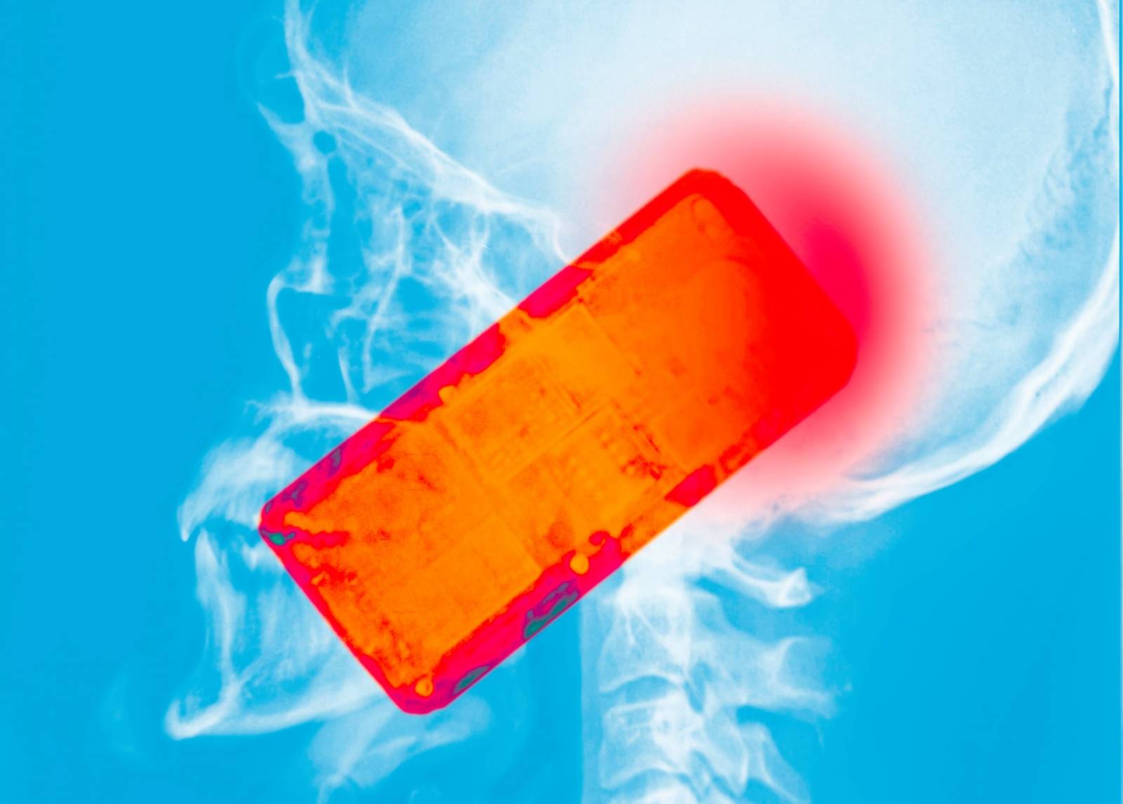 La verità scomoda su cancro e telefoni cellulari