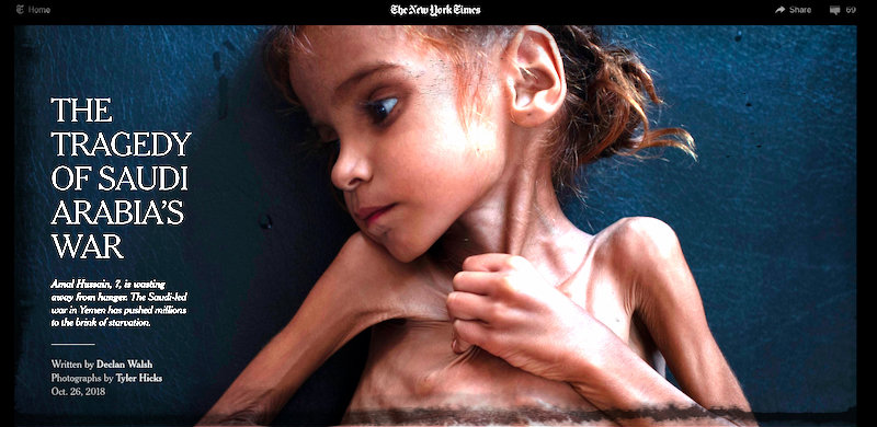 "La mia speranza se n'è andata": dopo la tragica morte della ragazza yemenita affamata, i genitori parlano in un'intervista