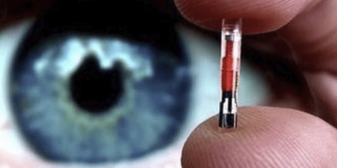 microchip implant human