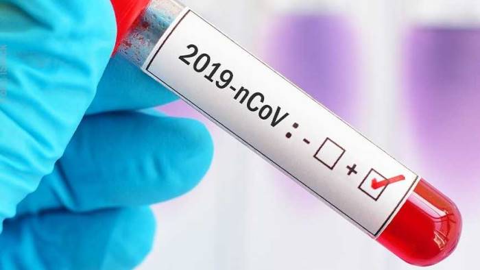 FACCIAMO LA NON-CHIAREZZA SU TAMPONI E TEST CoV-2...