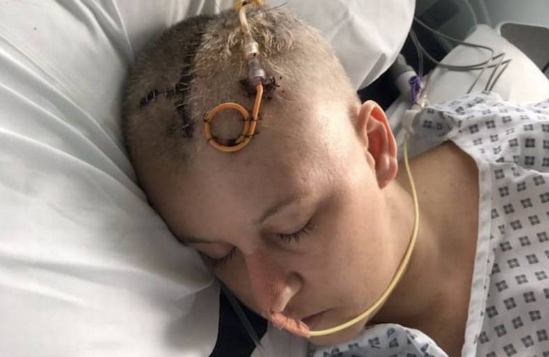 49enne grave trombosi dopo il vaccino