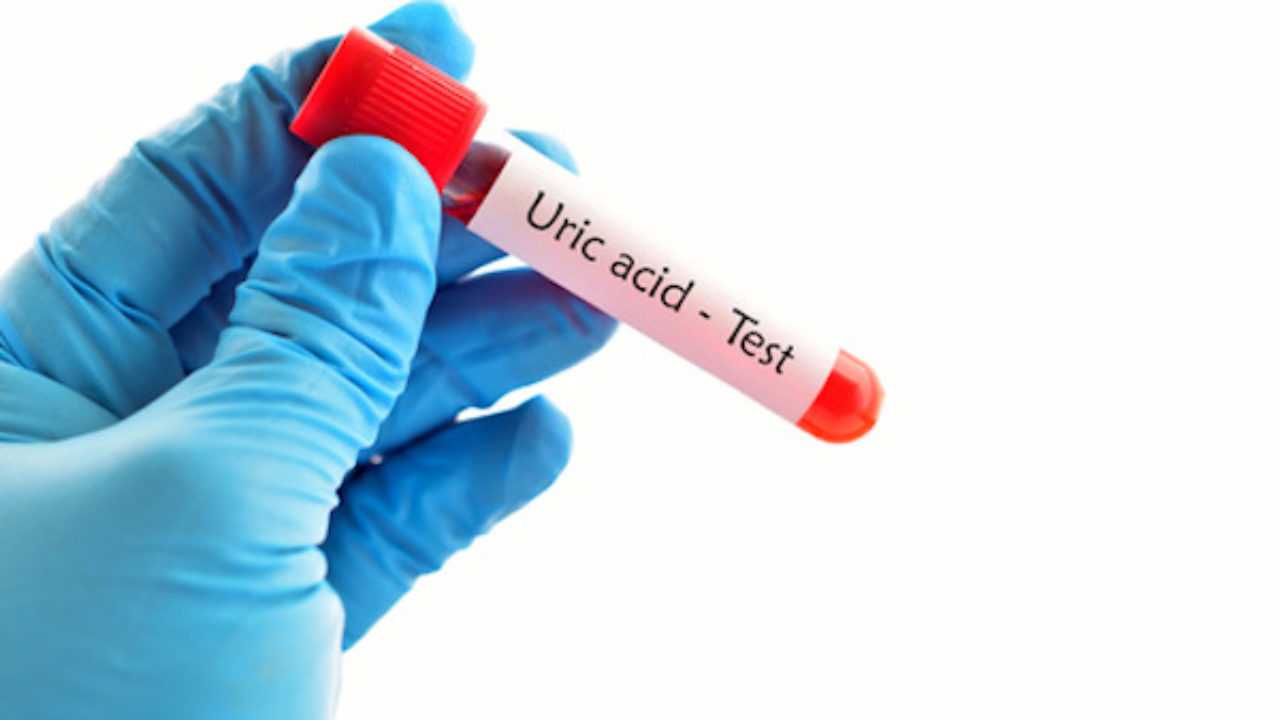 Acido urico alto, minaccia per cuore e circolazione