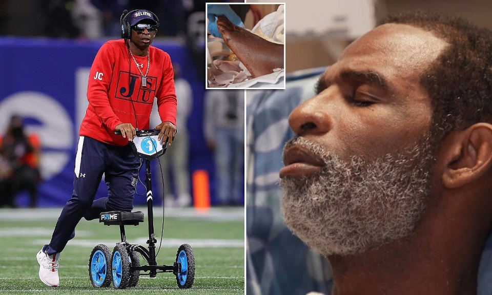 Deion Sanders ha avuto due dita amputate a seguito di coaguli di sangue