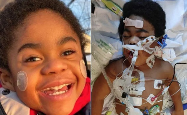 Milo, 6 anni, ricoverato e intubato due giorni dopo Pfizer.