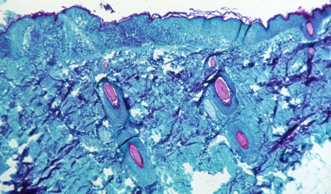 La paura del vaiolo delle scimmie potrà salvare alcune aziende in pericolo