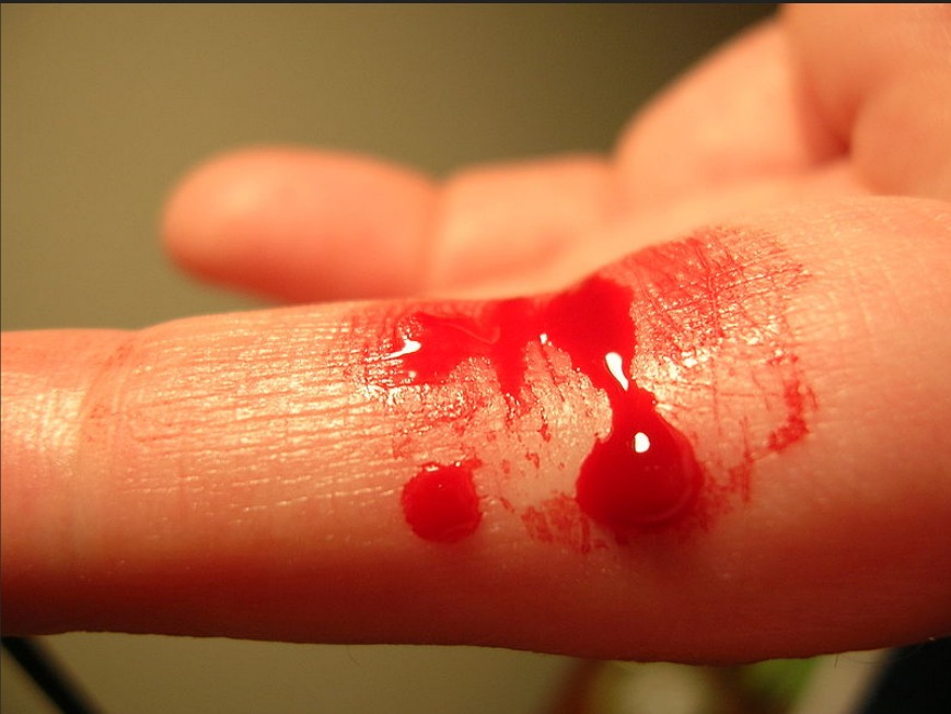 Prepariamoci al sangue!!!