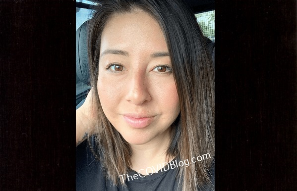 Donna australiana con alopecia dopo il vaccino