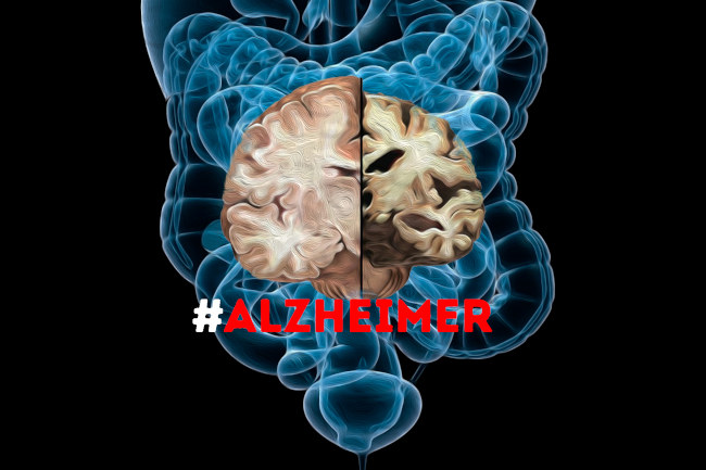 alzheimer microbiota