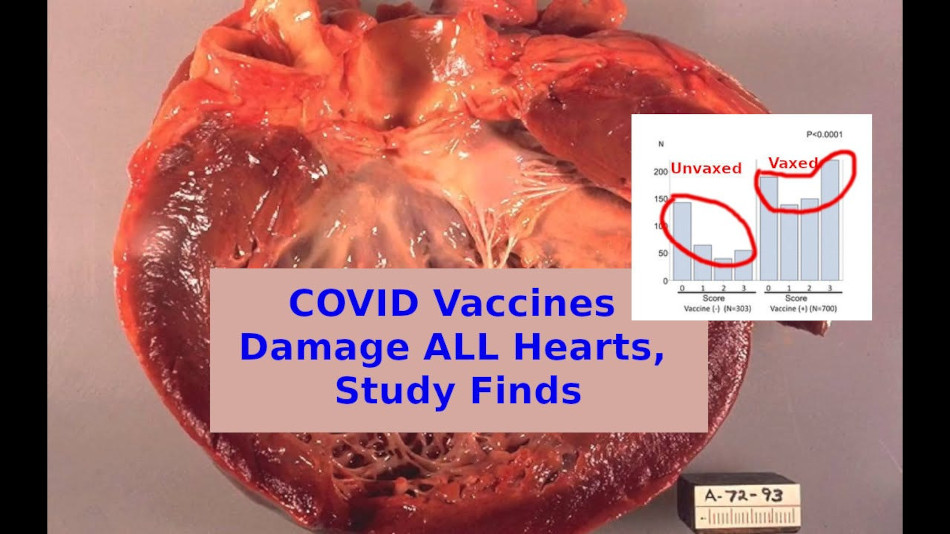 I vaccini Covid danneggiano SEMPRE il cuore, questo studio lo dimostra