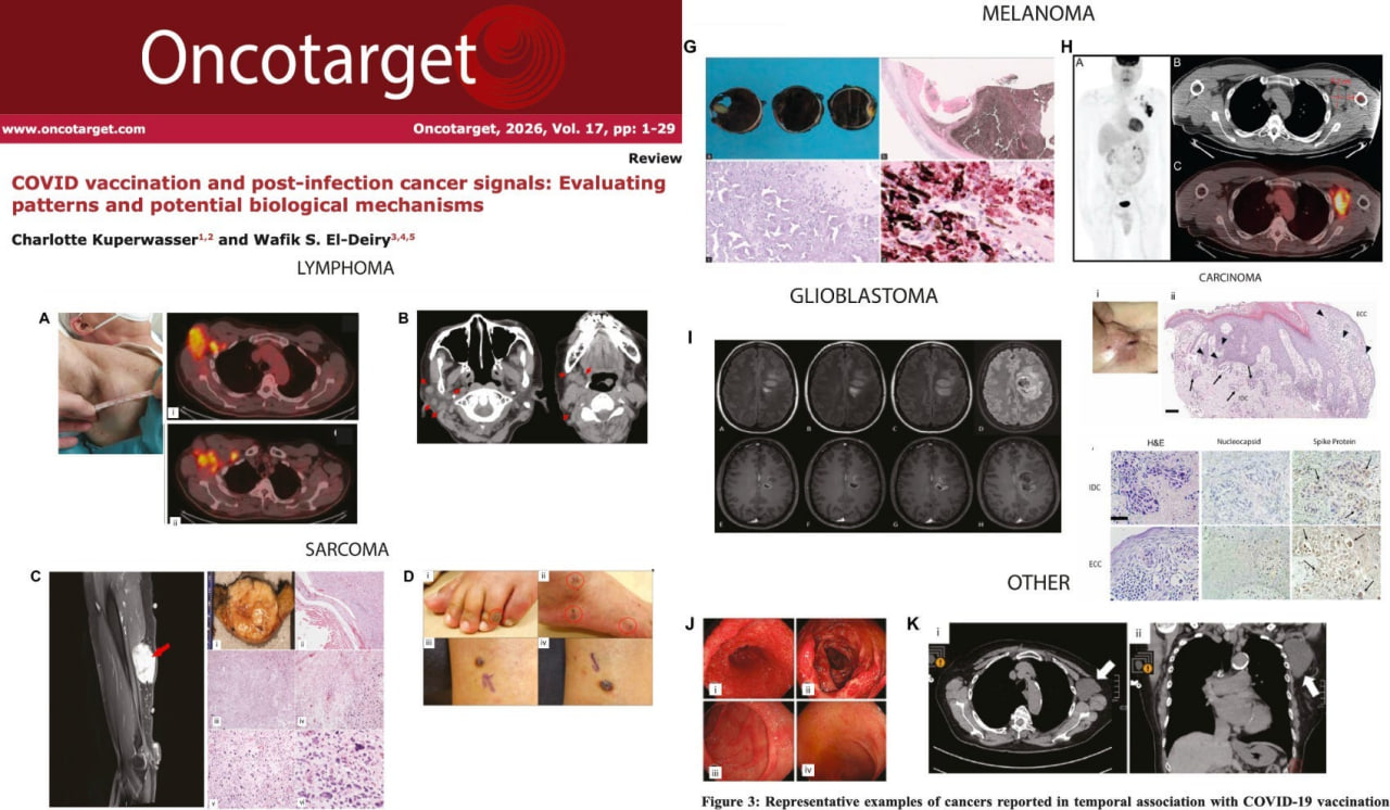 Uno studio identifica oltre 300 casi di cancro correlati al “vaccino” COVID-19 sottoposti a revisione paritaria in 27 paesi — Rivista colpita da attacchi informatici