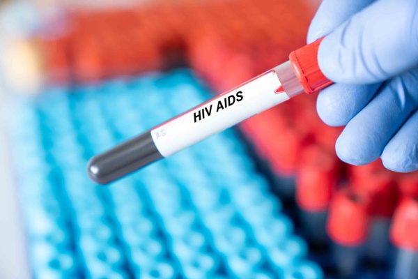 Il mito dell'HIV