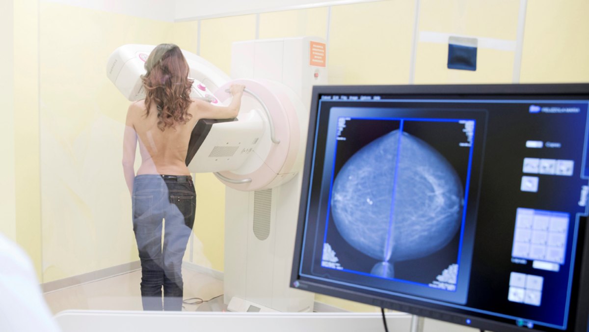 Cancro alla mammella: possibilità di sovradiagnosi