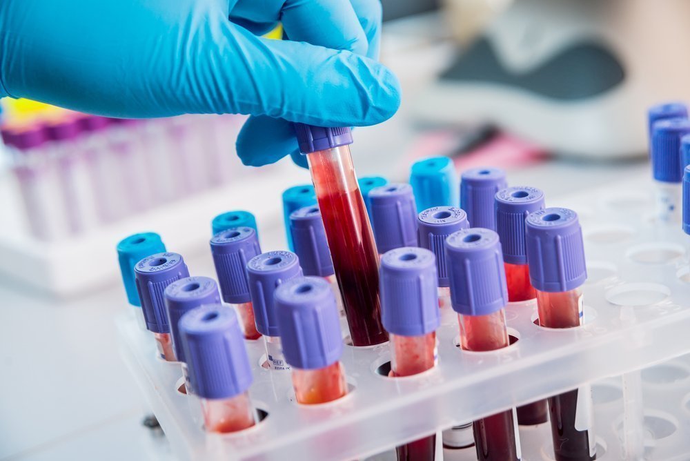 Trovate microplastiche nel sangue umano